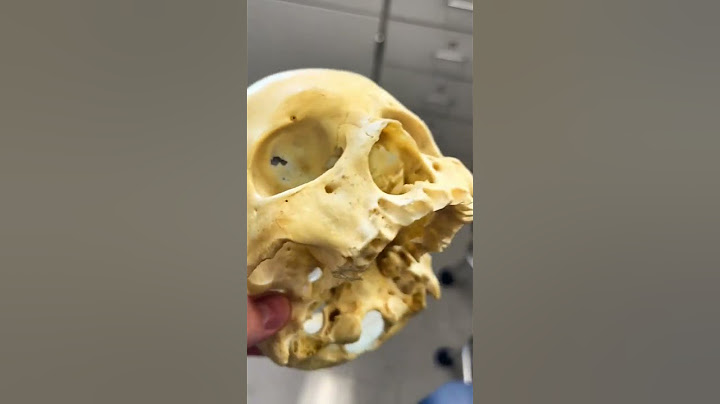 REAL Human Skull