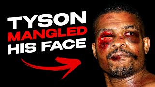 Tyson Smashed His Face – No One Could Believe It