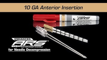 Enhanced ARS - 10 GA Anterior Decompression