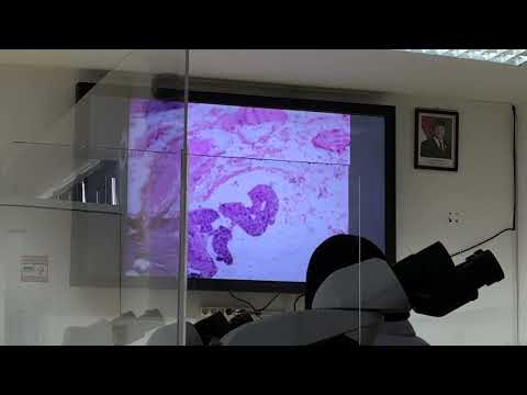 praktikum PA hematoimun