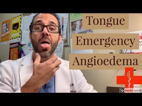 ቪዲዮ: Angioedema ከፍተኛ የደም ግፊት ያስከትላል?