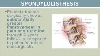 Full lecture by Dr. Sam Bederman on Innovations in Spine Surgery