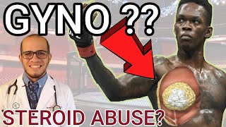 Israel Adesanya Gynecomastia, did he do steroids??? Doctor Reacts