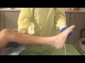 Ankle clonus