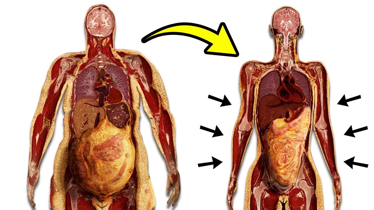 Как избавиться от висцерального жира у мужчин. Висцеральный жир на органах. Висцеральный жир вокруг желудка. Висцеральный жир анатомия. Висцеральная жировая ткань.