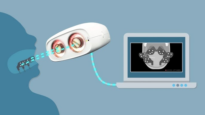 Keystone Dental Announces Market Launch of Nexus Connect, the First A.I.  Enabled Intraoral Implant-Scan Analyzer for the Nexus iOS Full-Arch  Solution