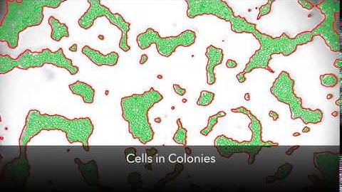 Bacterial Colony + Cell Counting Made Easy with MIPAR