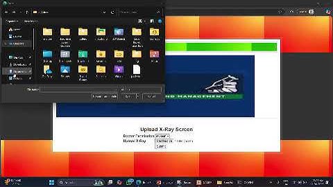 BONE FRACTURE DETECTION SYSTEM USING DEEP LEARNING