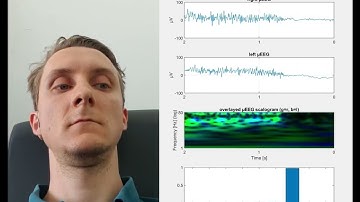 Wearable Wireless Ear EEG - Real Time Signal Classifier