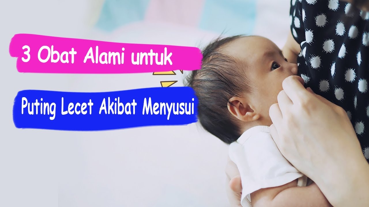 3 Obat Alami untuk Puting Lecet Akibat Menyusui