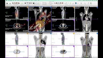 FusionSync Tutorial - Part 04: Manual Fusion Method