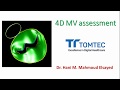 4d mv mitral valve assessment tomtec