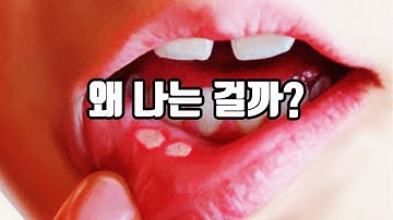 입병 자주 나는 사람들의 특징