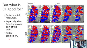 Methods_L4_1_fSNR_improvements