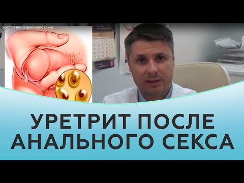 Уретрит после анального секса