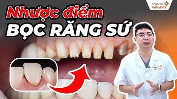 5 Nhược Điểm Bọc Răng Sứ - Nhiều Khách Hàng Đã Hối Hận Khi Bỏ Qua Điều Thứ 4