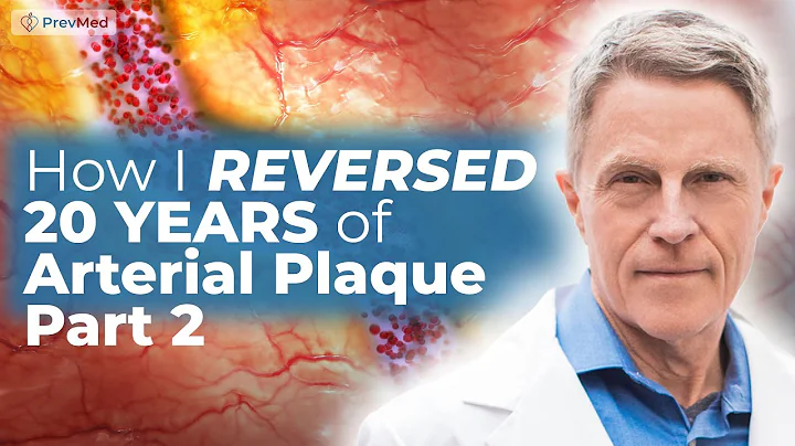 How I Reversed My Arterial Age 20 years (Part 2): My Scores