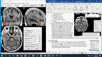 Intro to Lesion Drawing with MRIcron Part1
