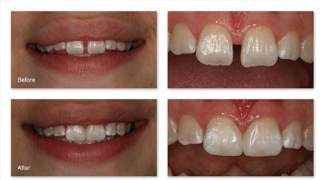 Before after. франкстон (виктория). автоклуб. полуночное животное фильм. Before close.