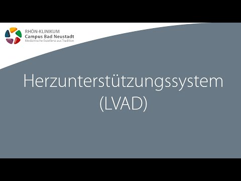 Herzunterstützungssystem (LVAD) - Infofilme zur Herz-OP | RHÖN-KLINIKUM Campus Bad Neustadt