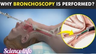 Bronchoscopy -Procedure To View inside of Airways/Urdu/Hindi/animation bronchoscopy