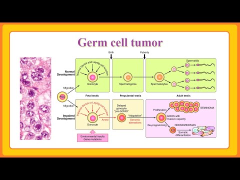 Video: In situ lytinių ląstelių neoplazija?