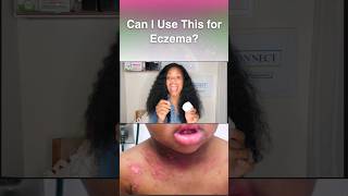 Will this help my child&#39;s Eczema?#eczema #psoriasis #acne #haircare #naturalhair