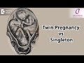 Twin Pregnancy vs Singleton -Dr Shetal Mehta of Cloudnine Hospitals | Doctors