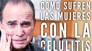 Episodio #252 Cómo Sufren Las Mujeres Con La Celulitis