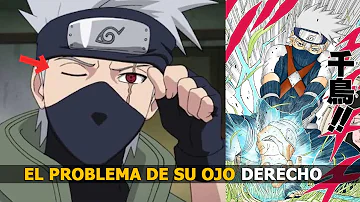 ¿Por qué Kakashi esconde su ojo izquierdo?