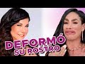 LIS VEGA DESTROZA su cara con Botox y Relleno