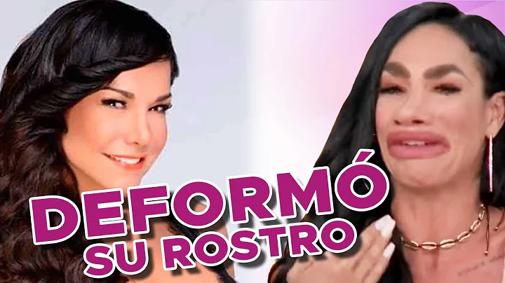 LIS VEGA DESTROZA su cara con Botox y Relleno