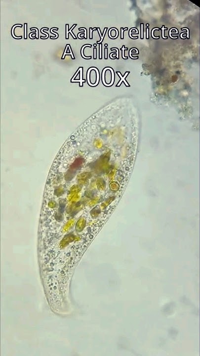 River Ciliate Karyorelictea YouTube