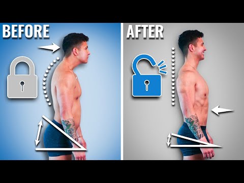 Fix Your Posture in 5 Minutes: Ultimate Guide | AI Posture Reminder