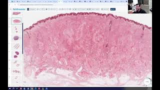 Avi Bitterman Lecture 18 (Neural)