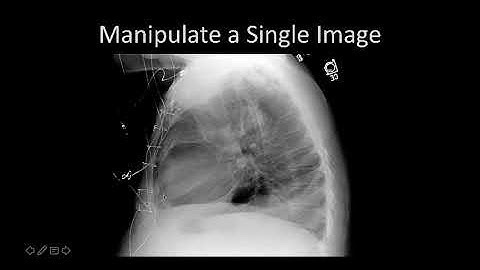 Introduction - ImageJ for Radiologists