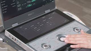 07 Measurement and Calculation Mindray MX7 Ultrasound