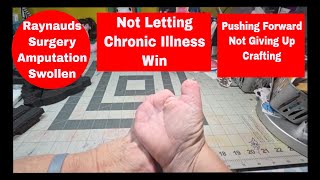 Swollen Thumb * Pushing Forward * Chronic Illnesses * Not Giving Up