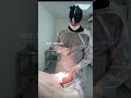 Часть 2. Сочетанная операция: височный лифтинг + ринопластика #подтяжкалица #ринопластика