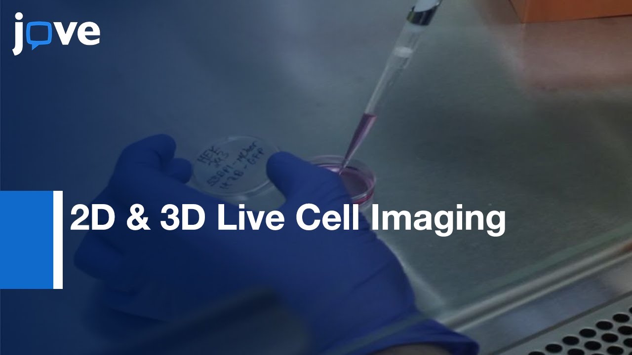 2D & 3D Live Cell Imaging Of DNA Damage Response Proteins l Protocol ...