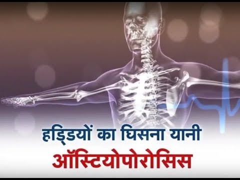 Kaise Hain Aap ? - Osteoporosis special farmers insurance