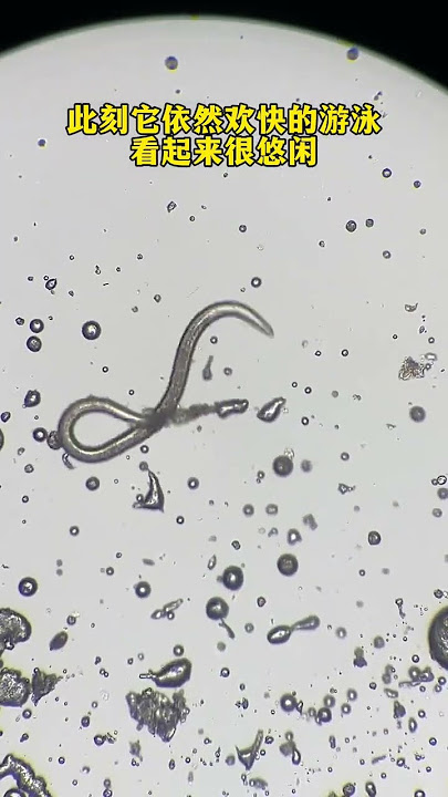 Can garlic defeat parasites? The world under the microscope Microscopic world Garlic