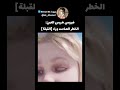 فيروس هربس العين الخطر الصامت وراء القبلة