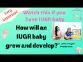 WILL IUGR BABIES BE NORMAL?  How will IUGR babies grow & develop?  Very important I iugr baby
