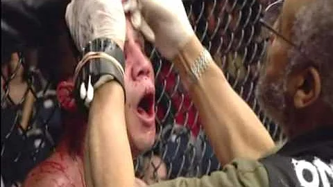 UFC 180 BJ Penn VS  joe stevenson