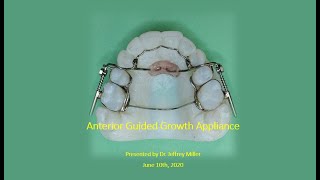Anterior Guided Growth Appliance,  AGGA,  Is it Safe?  No!