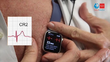 Un cardiólogo del H. Clínico descubre cómo hacer electrocardiogramas completos con un smartwatch