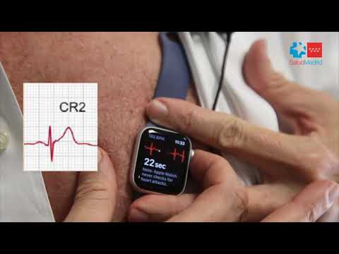 Video: ¿Es preciso el electrocardiograma en Apple Watch?