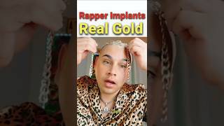 Celebrity This Rapper Implanted Gold Into His Head! 💀 Wealth