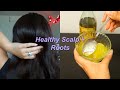 DIY Scalp Scrub for Dandruff + Buildup ♡